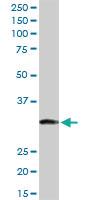 Anti-ITPK1 Rabbit Polyclonal Antibody