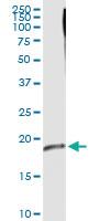 Anti-CRYGD Polyclonal Antibody Pair