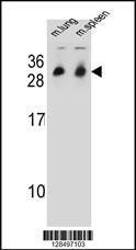 Anti-CYB561D1 Rabbit Polyclonal Antibody