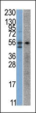 Anti-STK38 Rabbit Polyclonal Antibody