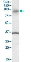 Anti-ANKK1 Goat Polyclonal Antibody