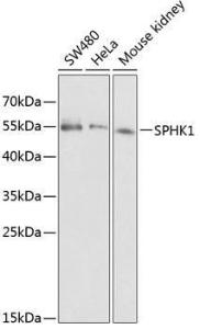 Anti-SPHK1 antibody