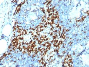 Immunohistochemical analysis of formalin-fixed, paraffin-embedded human lymph node using Anti-CD163 Antibody [M130/2164]