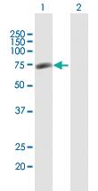 Anti-GPATCH4 Mouse Polyclonal Antibody