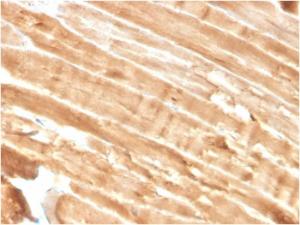 Immunohistochemical analysis of formalin-fixed, paraffin-embedded human skeletal muscle using Anti-Dystrophin Antibody [DMD/3244]