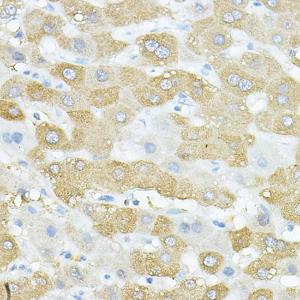 Anti-VEGFB Rabbit Polyclonal Antibody