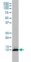 Anti-FKBP1A Mouse Monoclonal Antibody [clone: 1E5-A12]