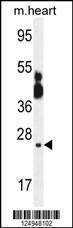 Anti-PCLI1 Rabbit Polyclonal Antibody (Biotin)