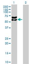 Anti-BACE Rabbit Polyclonal Antibody