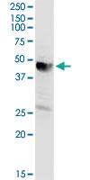 Anti-AACS Rabbit Polyclonal Antibody