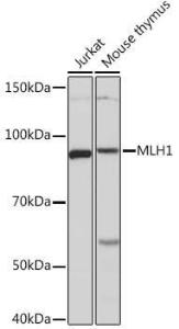 Western blot analysis of extracts of various cell lines, using Anti-mlH1 Antibody [ARC53543] (A308155) at 1:1,000 dilution