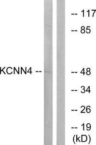 Western blot analysis of lysates from HepG2 cells using Anti-KCNN4 Antibody. The right hand lane represents a negative control, where the antibody is blocked by the immunising peptide.