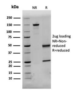 SDS-PAGE analysis of Anti-Dystrophin Antibody [DMD/3244] under non-reduced and reduced conditions; showing intact IgG and intact heavy and light chains, respectively. SDS-PAGE analysis confirms the integrity and purity of the antibody.