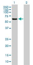 Anti-EPS8L1 Mouse Polyclonal Antibody