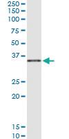 Anti-COL23A1 Polyclonal Antibody Pair