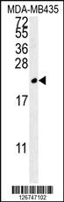 Anti-TREM2 Rabbit Polyclonal Antibody