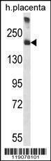 Anti-A2M Rabbit Polyclonal Antibody (HRP (Horseradish Peroxidase))