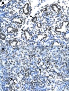 Anti-CLDN17 Rabbit Polyclonal Antibody