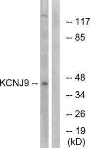 Western blot analysis of lysates from LOVO cells using Anti-KCNJ9 Antibody. The right hand lane represents a negative control, where the antibody is blocked by the immunising peptide.