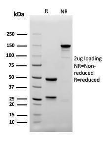 SDS-PAGE analysis of Anti-CD4 Antibody [rC4/206] under non-reduced and reduced conditions; showing intact IgG and intact heavy and light chains, respectively SDS-PAGE analysis confirms the integrity and purity of the antibody