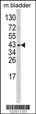 Anti-WNT5B Rabbit Polyclonal Antibody