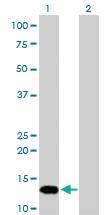 Anti-FKBP1A Mouse Monoclonal Antibody [clone: 1E5-A12]