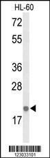 Anti-IL26 Rabbit Polyclonal Antibody (AP (Alkaline Phosphatase))