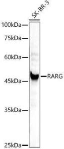 Western blot analysis of extracts of SK-BR-3 cells, using Anti-Retinoic Acid Receptor gamma Antibody (A307066) at 1:1,000 dilution