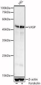 Western blot analysis of HEL, using Anti-VASP Antibody (A12532) at 1:600 dilution