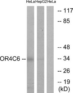 Antibody anti-OR4C6 A99793-100 100 µg