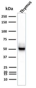 Western blot analysis of human thymus tissue lysate using Anti-Cytokeratin 15 Antibody [KRT15/2957]