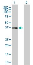 Anti-CFHR1 Mouse Polyclonal Antibody