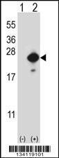 Anti-CFL2 Rabbit Polyclonal Antibody (HRP (Horseradish Peroxidase))