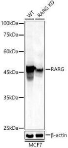 Western blot analysis of extracts from wild type (WT) and RARG knockdown (KD) MCF7 cells, using Anti-Retinoic Acid Receptor gamma Antibody (A307066) at 1:1,000 dilution