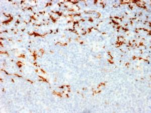 Immunohistochemical analysis of formalin-fixed, paraffin-embedded human lymph node in colon using Anti-CD163 Antibody [M130/2164]