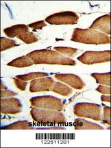 Anti-MARCH1 Rabbit Polyclonal Antibody