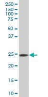 Anti-RAB32 Mouse Polyclonal Antibody