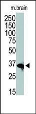 Anti-HDAC11 Rabbit Polyclonal Antibody (FITC (Fluorescein))