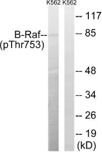 Western blot analysis of lysates from K562 cells treated with EGF 200ng/ml 30' using Anti-B-Raf (phospho Thr753) Antibody. The right hand lane represents a negative control, where the antibody is blocked by the immunising peptide