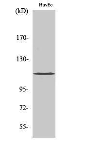 Anti-KCNH1 antibody