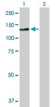 Anti-SMARCAL1 Mouse Polyclonal Antibody