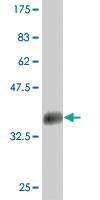 Anti-LBX1 Mouse Monoclonal Antibody [clone: 2A9]