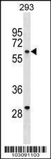 Anti-YES1 Rabbit Polyclonal Antibody (AP (Alkaline Phosphatase))