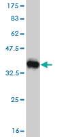 Anti-ERAP1 Mouse Monoclonal Antibody [clone: 4H8]