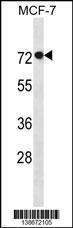 Anti-AGAP11 Rabbit Polyclonal Antibody (HRP (Horseradish Peroxidase))