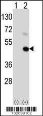 Anti-MAGEA9 Rabbit Polyclonal Antibody (Biotin)