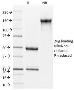 SDS-PAGE analysis of Anti-Cytokeratin 15 Antibody [KRT15/2957] under non-reduced and reduced conditions; showing intact IgG and intact heavy and light chains, respectively. SDS-PAGE analysis confirms the integrity and purity of the Antibody