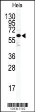 Anti-ILK2/ILK1 Rabbit Polyclonal Antibody