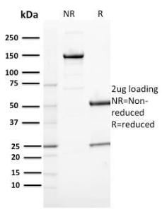 SDS-PAGE analysis of Anti-CD163 Antibody [M130/2164] under non-reduced and reduced conditions; showing intact IgG and intact heavy and light chains, respectively. SDS-PAGE analysis confirms the integrity and purity of the antibody.