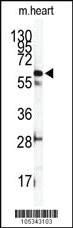 Anti-ILK2/ILK1 Rabbit Polyclonal Antibody